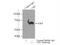 Cystathionine-Beta-Synthase antibody, 14787-1-AP, Proteintech Group, Immunoprecipitation image 