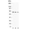 CD86 antibody, R30465, NSJ Bioreagents, Western Blot image 