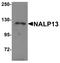 NLR Family Pyrin Domain Containing 13 antibody, NBP1-76294, Novus Biologicals, Western Blot image 