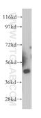 Protein Phosphatase Methylesterase 1 antibody, 14435-1-AP, Proteintech Group, Western Blot image 