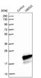 Mediator Complex Subunit 22 antibody, NBP1-87818, Novus Biologicals, Western Blot image 