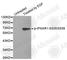 Interferon Alpha And Beta Receptor Subunit 1 antibody, AP0366, ABclonal Technology, Western Blot image 