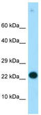 Regulator Of G Protein Signaling 19 antibody, TA334728, Origene, Western Blot image 