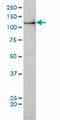 BUB1 Mitotic Checkpoint Serine/Threonine Kinase antibody, ab54893, Abcam, Western Blot image 