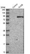 Glucuronidase Beta antibody, NBP1-87511, Novus Biologicals, Western Blot image 