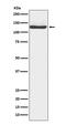Janus Kinase 3 antibody, M02598-1, Boster Biological Technology, Western Blot image 