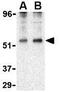 Perilipin 3 antibody, GTX85492, GeneTex, Western Blot image 