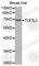 Transcription Factor 7 Like 2 antibody, A1379, ABclonal Technology, Western Blot image 