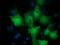 Lin-7 Homolog B, Crumbs Cell Polarity Complex Component antibody, M09113, Boster Biological Technology, Immunofluorescence image 