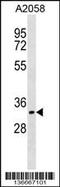 Cyclin Dependent Kinase 5 Regulatory Subunit 1 antibody, 63-179, ProSci, Western Blot image 