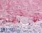 Lemur Tyrosine Kinase 2 antibody, LS-B8423, Lifespan Biosciences, Immunohistochemistry frozen image 