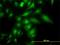 Trafficking Protein Particle Complex 4 antibody, H00051399-M01, Novus Biologicals, Immunofluorescence image 