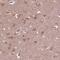 Zinc Finger Protein 292 antibody, NBP2-55356, Novus Biologicals, Immunohistochemistry paraffin image 
