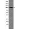 Toll Like Receptor 3 antibody, PA5-64722, Invitrogen Antibodies, Western Blot image 