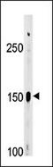 ABL Proto-Oncogene 2, Non-Receptor Tyrosine Kinase antibody, PA5-12537, Invitrogen Antibodies, Western Blot image 