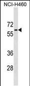 Phosphoglucomutase 5 antibody, PA5-48880, Invitrogen Antibodies, Western Blot image 