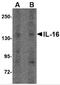 Interleukin 16 antibody, 4985, ProSci, Western Blot image 