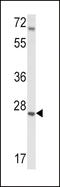 Insulin Like Growth Factor Binding Protein 4 antibody, LS-C165150, Lifespan Biosciences, Western Blot image 