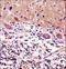 Cerebellar Degeneration Related Protein 2 antibody, LS-C168633, Lifespan Biosciences, Immunohistochemistry frozen image 