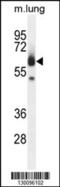 Zinc Finger Containing Ubiquitin Peptidase 1 antibody, 55-315, ProSci, Western Blot image 