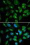 Killer Cell Immunoglobulin Like Receptor, Two Ig Domains And Long Cytoplasmic Tail 3 antibody, LS-C331641, Lifespan Biosciences, Immunofluorescence image 