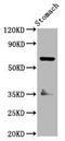 Sodium-iodide symporter antibody, LS-C681382, Lifespan Biosciences, Western Blot image 