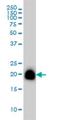 Ras Homolog Family Member A antibody, H00000387-M08, Novus Biologicals, Western Blot image 