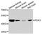 Pyruvate Dehydrogenase Kinase 3 antibody, A8028, ABclonal Technology, Western Blot image 
