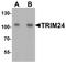 Tripartite Motif Containing 24 antibody, NBP2-41220, Novus Biologicals, Western Blot image 