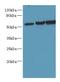 Oxysterol-binding protein-related protein 2 antibody, LS-C379964, Lifespan Biosciences, Western Blot image 