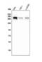 SWI/SNF Related, Matrix Associated, Actin Dependent Regulator Of Chromatin, Subfamily A, Member 2 antibody, M01888-1, Boster Biological Technology, Western Blot image 