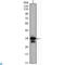 Cyclin Dependent Kinase 1 antibody, LS-C812421, Lifespan Biosciences, Immunohistochemistry paraffin image 