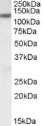 UDP-GlcNAc:BetaGal Beta-1,3-N-Acetylglucosaminyltransferase 2 antibody, orb19651, Biorbyt, Western Blot image 