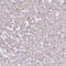 Charged Multivesicular Body Protein 4B antibody, HPA041401, Atlas Antibodies, Immunohistochemistry paraffin image 