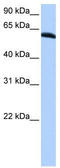 Thyroid Hormone Receptor Interactor 6 antibody, TA339222, Origene, Western Blot image 