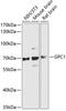 Glypican-1 antibody, 14-748, ProSci, Western Blot image 