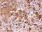 Transferrin antibody, PB9827, Boster Biological Technology, Immunohistochemistry paraffin image 