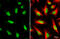 Tumor Protein P53 Binding Protein 1 antibody, GTX70310, GeneTex, Immunocytochemistry image 