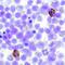 C-Type Lectin Domain Containing 9A antibody, MA5-24319, Invitrogen Antibodies, Immunohistochemistry paraffin image 