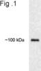 Ubiquitin Protein Ligase E3A antibody, PA3-843, Invitrogen Antibodies, Western Blot image 
