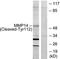 Matrix Metallopeptidase 14 antibody, LS-C121088, Lifespan Biosciences, Western Blot image 