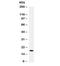 S100 Calcium Binding Protein A8 antibody, R32039, NSJ Bioreagents, Western Blot image 