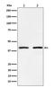SET And MYND Domain Containing 3 antibody, M02080, Boster Biological Technology, Western Blot image 