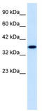 Zinc Finger Protein 75D antibody, TA339145, Origene, Western Blot image 