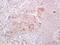 Integrin Subunit Alpha 3 antibody, 251177, Abbiotec, Immunohistochemistry paraffin image 