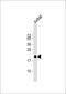 Apolipoprotein B MRNA Editing Enzyme Catalytic Subunit 3A antibody, 60-931, ProSci, Western Blot image 