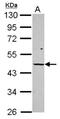 Vitamin D Receptor antibody, NBP2-20865, Novus Biologicals, Western Blot image 