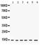 Hint antibody, PA5-79363, Invitrogen Antibodies, Western Blot image 