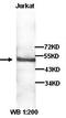 Zinc Finger FYVE-Type Containing 27 antibody, orb77316, Biorbyt, Western Blot image 