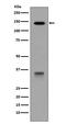 Low Density Lipoprotein Receptor antibody, M00076, Boster Biological Technology, Western Blot image 